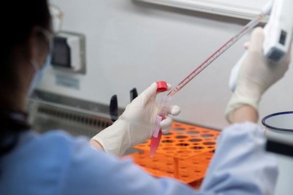 Clipping – El País - A intensidade da pandemia que o Brasil (quase) não contabiliza