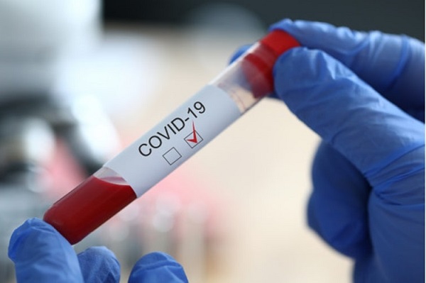 Bem Paraná – Pandemia da Covid-19 dá sinais de recuo no Paraná, mas variante delta preocupa